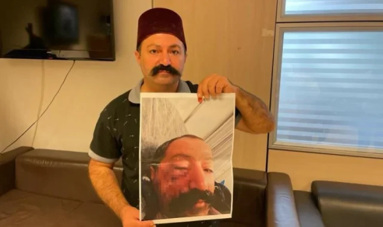 Sosyal medya fenomeni, ev sahibi tarafından darp edildiğini iddia etti