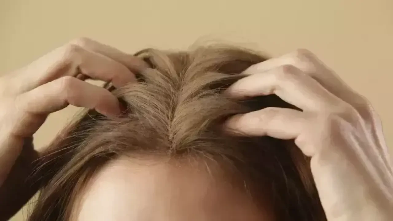 Kuru Şampuan Gerçeği! Saçta Mucize Gibi Görünüyor Ama Sağlık Açısından Büyük Tehlike Saçıyor 4
