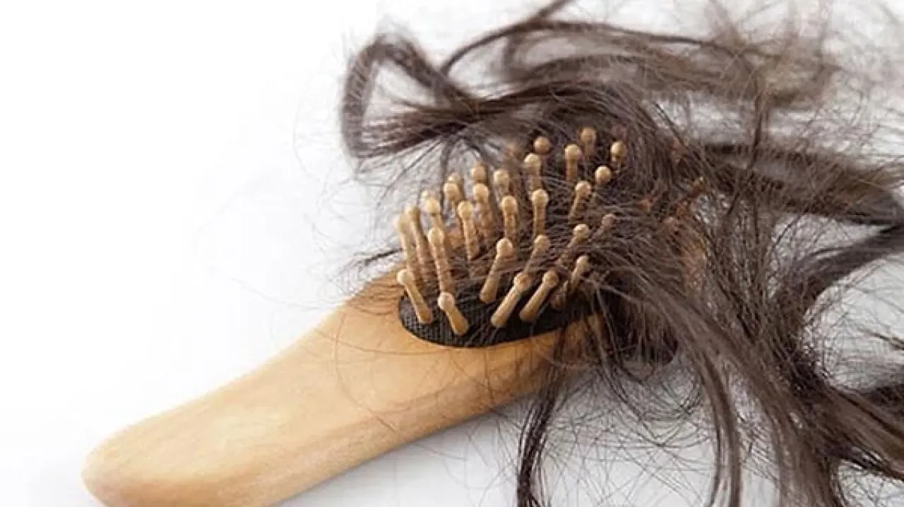 Rüyada Çok Fazla Saç Dökülmesi Görmek Ne Anlama Gelir? 2