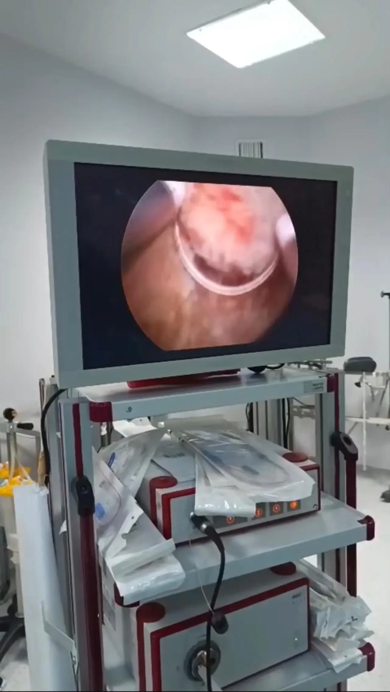 Merzifon Kara Mustafa Paşa Devlet Hastanesi’nden Sağlıkta Güçlü Teknoloji Hamlesi 1