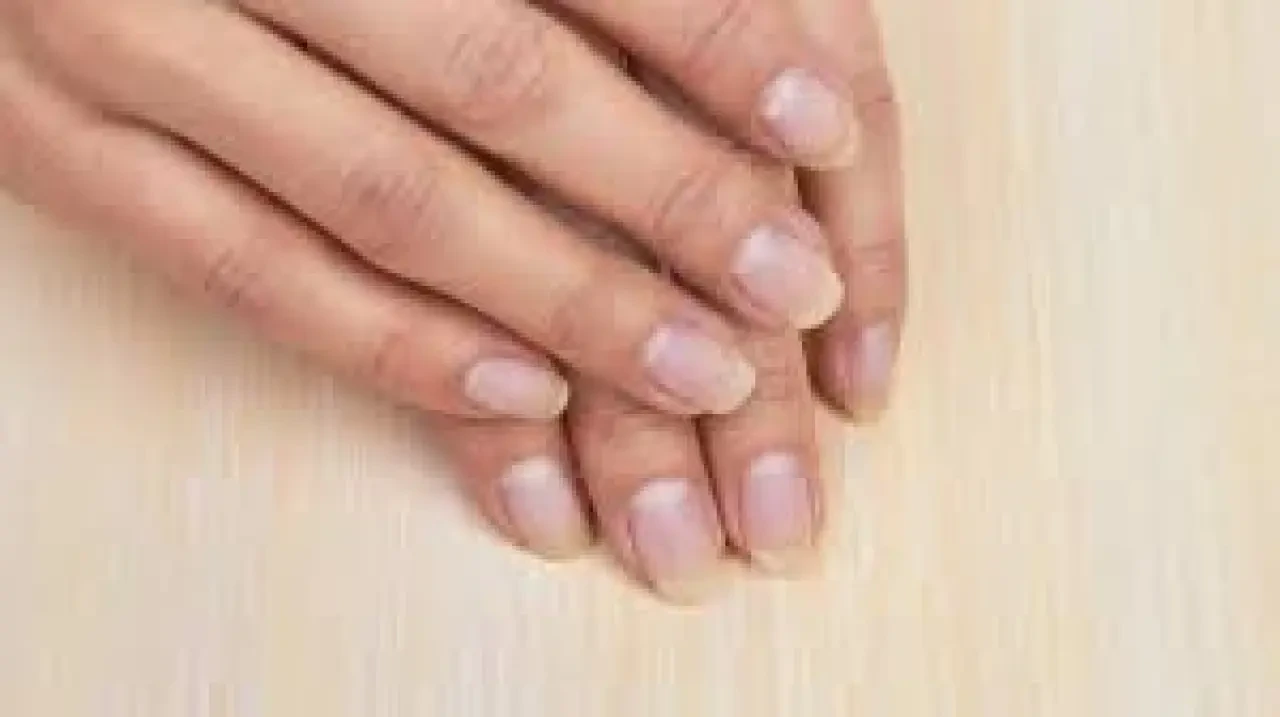 Sararmış Tırnaklar Neden Olur? Uzmanlar Uyarıyor: Basit Bir Sorun Olmayabilir 2