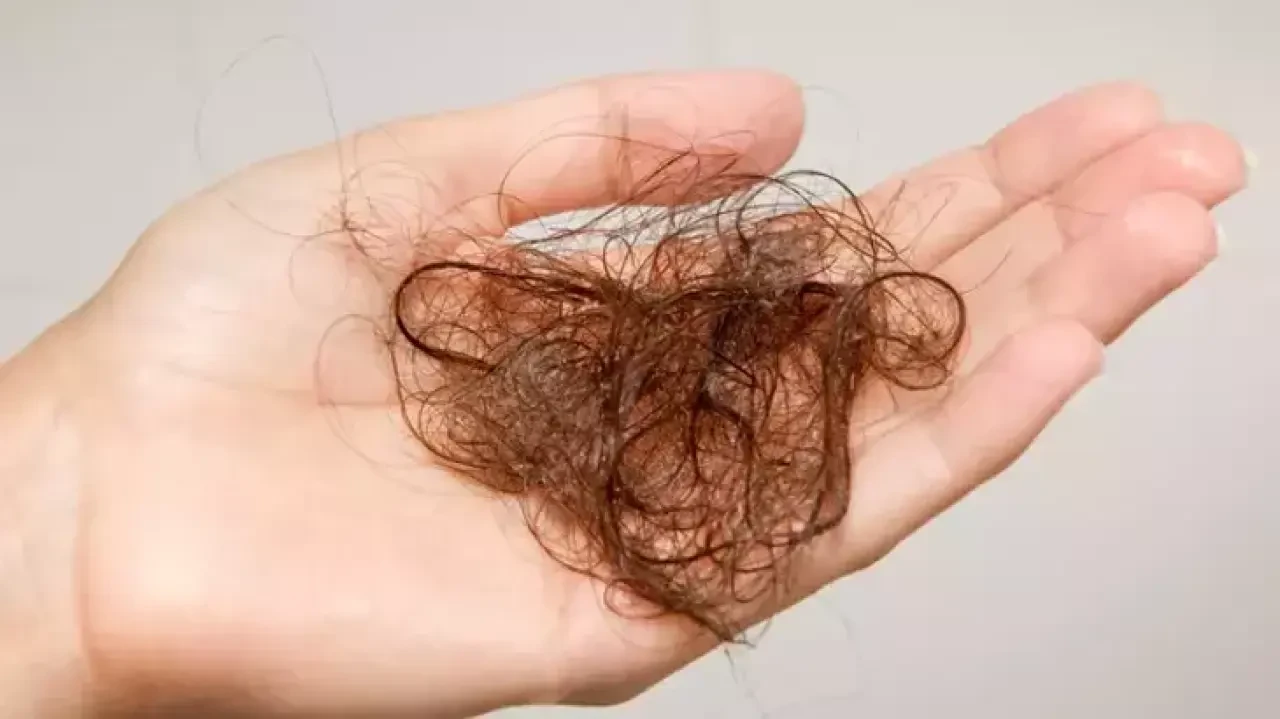 Rüyada Kıl Görmek Ne Anlama Gelir? Dikkat Çeken Detaylar ve Yorumlar 1