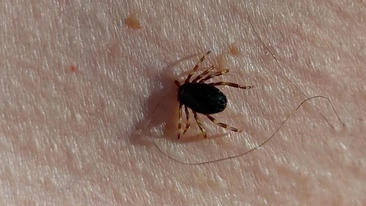 Çorum’da kenenin ısırdığı adam kurtarılamadı