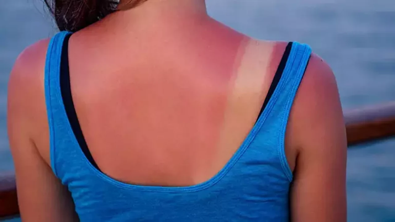 Her Bronzlaştırıcı Aynı Etkiyi Yaratmaz! Cilt Sağlığınız İçin Bu Kurallara Dikkat