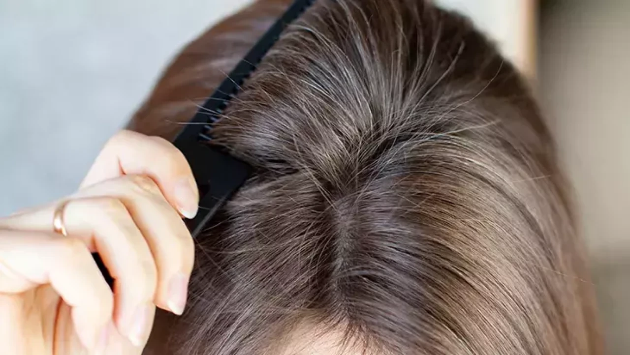 Sıcakta Yanan ve Kızaran Saç Derisi İçin Etkili Çözümler! Jel ve Serum Desteği Şart