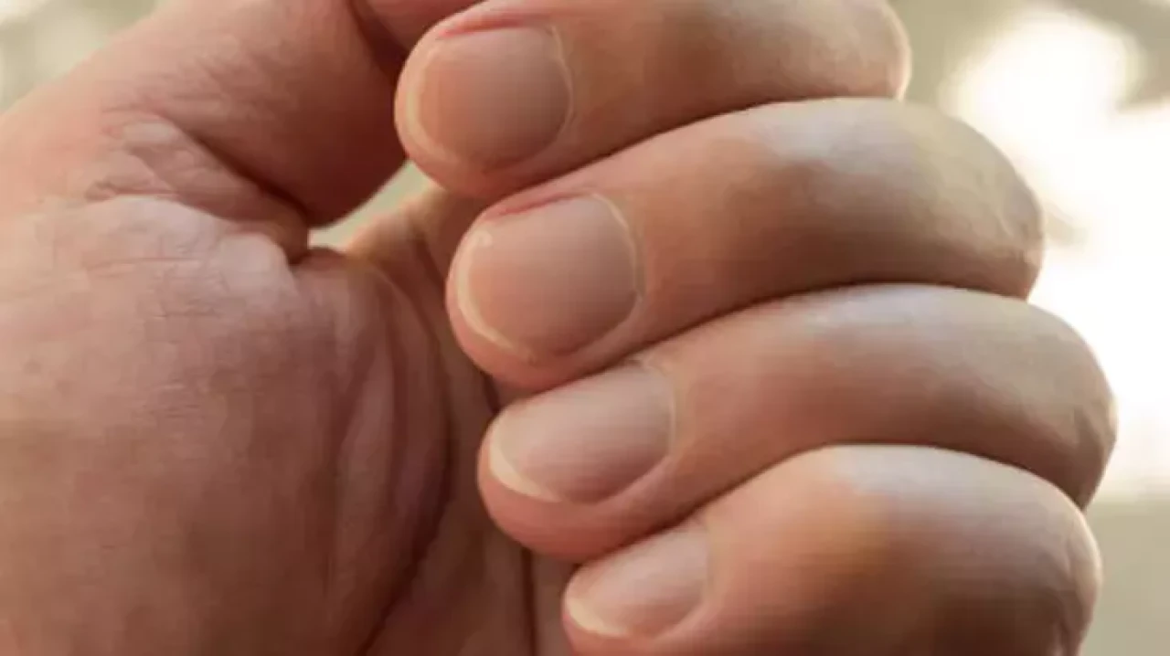 Tırnakları Bembeyaz Yapan Mucize: 1 Kaşık Yeter!