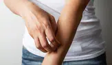 Rüyada Kaşıntı Görmek Ne Anlama Gelir?