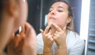 Çenedeki Siyah Noktalar İçin Mükemmel Çözüm! Buharla Aç, Salisilik Asitle Arındır