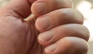 Tırnakları Bembeyaz Yapan Mucize: 1 Kaşık Yeter!