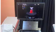 Taşova Devlet Hastanesi’ne Yeni Nesil Renkli Doppler Ultrason Cihazı