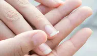 Rüyada Kırılmış Tırnak Görmek Ne Anlama Geliyor? Bu Detay Dikkat Çekiyor!
