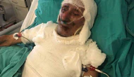 Kardeşini Yakmaya Kalktı, Cezası Belli Oldu