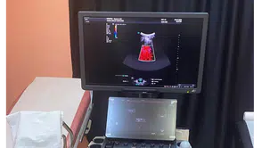 Taşova Devlet Hastanesi’ne Yeni Nesil Renkli Doppler Ultrason Cihazı