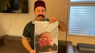 Sosyal medya fenomeni, ev sahibi tarafından darp edildiğini iddia etti