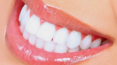 Diş Beyazlatmada Yeni Trend: Doğal ve Hızlı Çözümler Gündemde