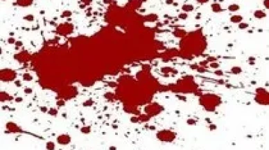 Rüyada Diş Kanaması Görmek Ne Anlama Gelir? İşte Rüya Tabirlerine Göre Yorumlar