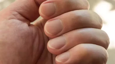 Tırnakları Bembeyaz Yapan Mucize: 1 Kaşık Yeter!