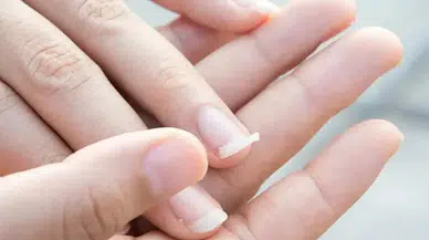 Rüyada Kırılmış Tırnak Görmek Ne Anlama Geliyor? Bu Detay Dikkat Çekiyor!