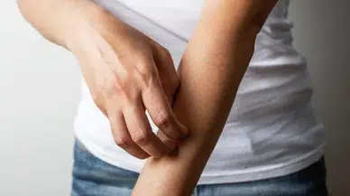 Rüyada Kaşıntı Görmek Ne Anlama Gelir?