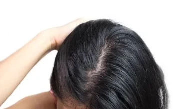 SAÇLAR HER GÜN MÜ YIKANMALI, YOKSA HAFTADA İKİ KERE Mİ? UZMANLAR UYARIYOR!