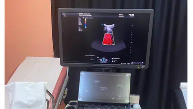 Taşova Devlet Hastanesi’ne Yeni Nesil Renkli Doppler Ultrason Cihazı