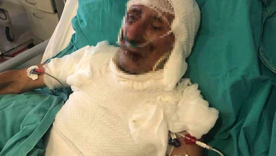 Kardeşini Yakmaya Kalktı, Cezası Belli Oldu