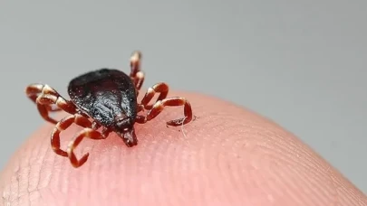 KKKA HASTALIĞI ŞÜPHESİYLE ÖLÜM