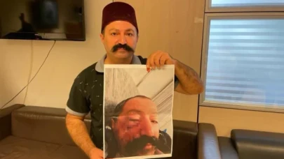 Sosyal medya fenomeni, ev sahibi tarafından darp edildiğini iddia etti
