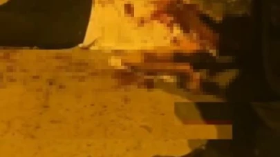 Tartışma silahlı kavgaya dönüştü: 2 yaralı
