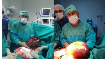 GENÇ KIZIN KARNINDAN 5 KG’LIK KİTLE ÇIKARILDI
