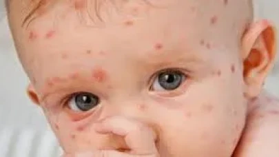 Rüyada Su Çiçeği Görmek Ne Anlama Gelir? İşte Detaylı Yorumlar