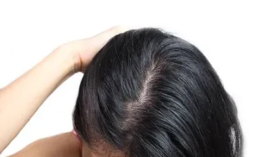 SAÇLAR HER GÜN MÜ YIKANMALI, YOKSA HAFTADA İKİ KERE Mİ? UZMANLAR UYARIYOR!