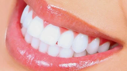 Diş Beyazlatmada Yeni Trend: Doğal ve Hızlı Çözümler Gündemde