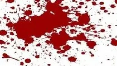 Rüyada Diş Kanaması Görmek Ne Anlama Gelir? İşte Rüya Tabirlerine Göre Yorumlar