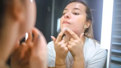 Çenedeki Siyah Noktalar İçin Mükemmel Çözüm! Buharla Aç, Salisilik Asitle Arındır