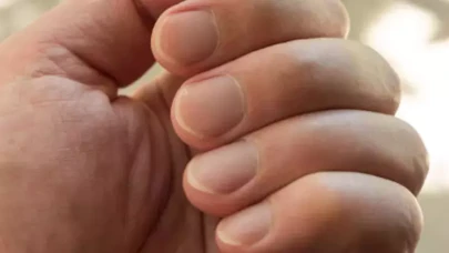 Tırnakları Bembeyaz Yapan Mucize: 1 Kaşık Yeter!