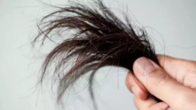 Nemli Havada Kabaran ve Kırılan Saçlara Son! Saçlarınızı Kurtaracak Vitamin Deposu Besinler