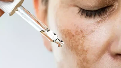 Gece Bakımıyla Cilt Lekelerine Veda!