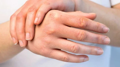 Sonbaharda Cilt Kuruluğuna Dikkat