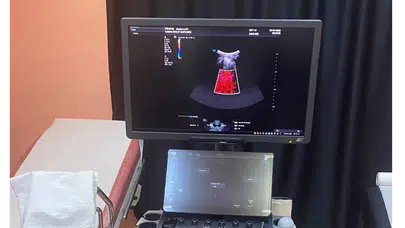 Taşova Devlet Hastanesi’ne Yeni Nesil Renkli Doppler Ultrason Cihazı