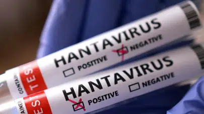 Sağlık Bakanlığı’ndan Hantavirüs Açıklaması!
