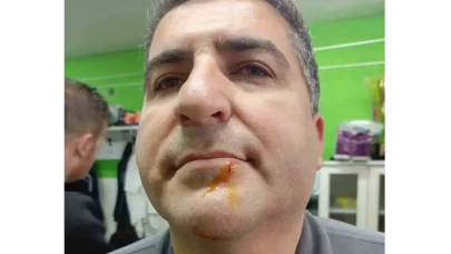 3. Lig maçı sonrası gerginlik: 2 gazeteci darbedildi, 2 polis yaralandı