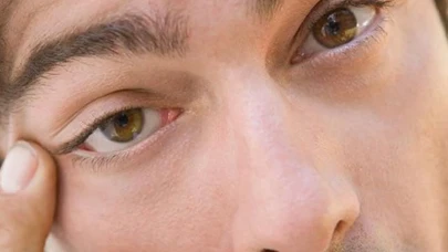 Rüyada Göz Seyirmesi Görmek Ne Anlama Gelir? İşte Merak Edilen Yorumlar