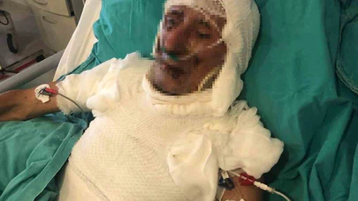 Kardeşini Yakmaya Kalktı, Cezası Belli Oldu