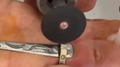 Parmağına yüzük sıkışan kadının yardımına itfaiye yetişti