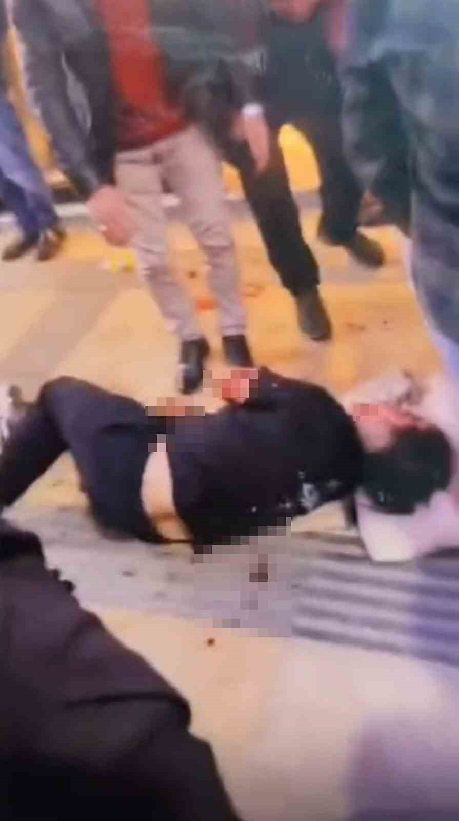 gumushanede-bosanma-asamasindaki-esi-tarafindan-bicaklanan-kadin-yaralandi