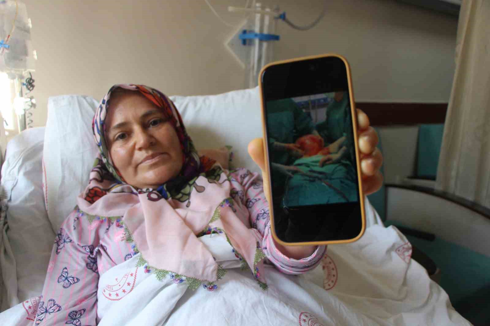 karni-2-ayda-9-aylik-hamile-gibi-buyuyen-kadinin-icinden-karpuz-kadar-kitle-cikarildi