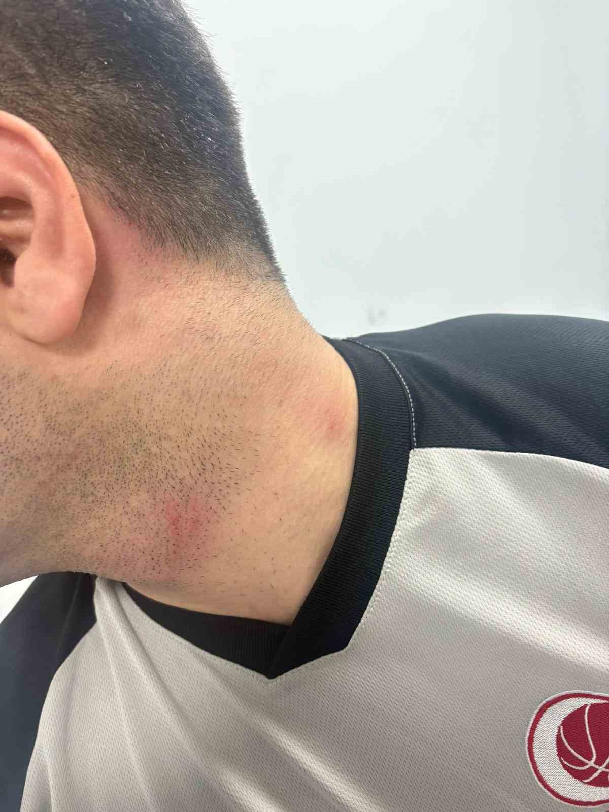 samsunda-basketbol-macinda-oyuncu-hakeme-saldirdi