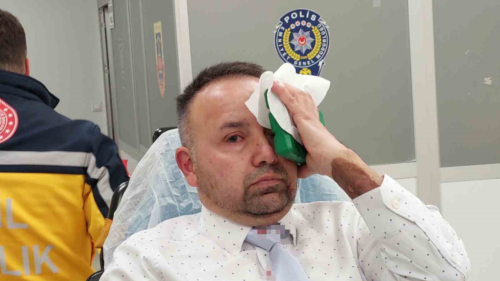 okuldan-atilan-ogrenci-okula-gelip-nobetci-ogretmene-saldirarak-hastanelik-etti