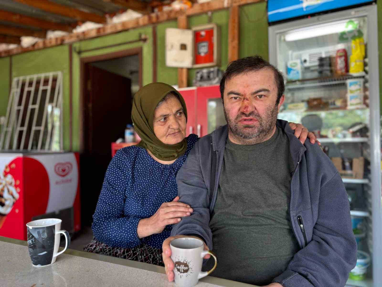 yuzde-90-engelli-vatandas-acimasizca-darp-edildi